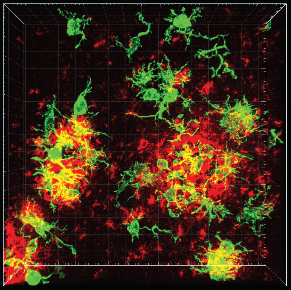 Microglia and amyloid beta, with volumetric reconstruction