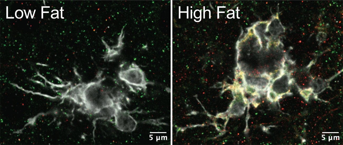 Microglia, inhibitory synapses, and NRG3
