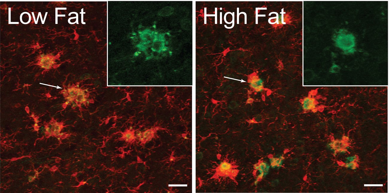 Microglia co-labeled with Trem2